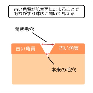 hirakikeana